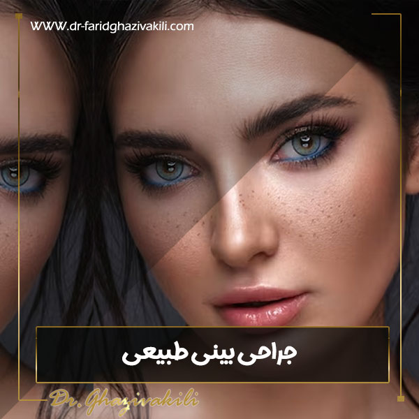 جراحی بینی طبیعی در تبریز - دکتر فرید قاضی وکیلی-dr-faridghazivakili.com