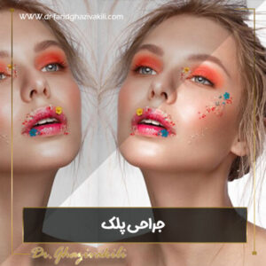 جراحی پلک در تبریز - دکتر فرید قاضی وکیلی
