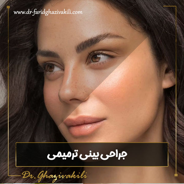 جراحی بینی ترمیمی - دکتر فرید قاضی وکیلی-dr-faridghazivakili.com