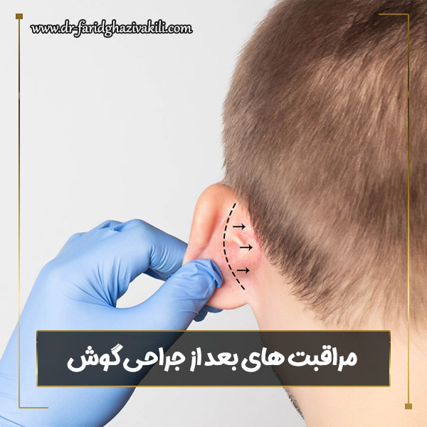 مراقبت های بعد از جراحی گوش - دکتر فرید قاضی وکیلی- dr-faridghazivakili.com