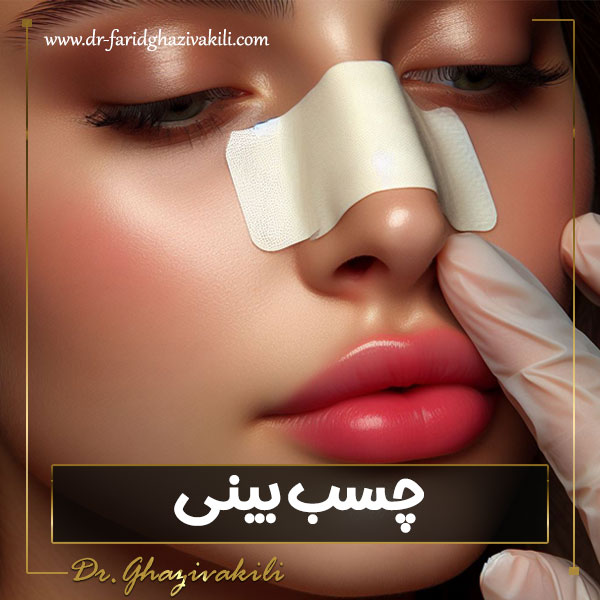 چسب بینی - دکتر فرید قاضی وکیلی-dr-faridghazivakili.com