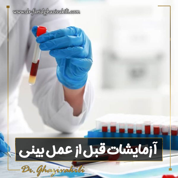 آزمایشات قبل از عمل بینی - دکتر فرید قاضی وکیلی