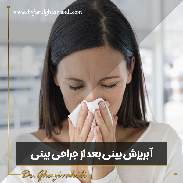 آبریزش بینی بعد از جراحی بینی- دکتر فرید قاضی وکیلی - dr-faridghazivakili.com