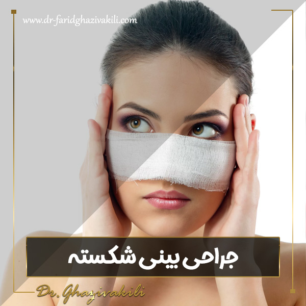 جراحی بینی شکسته - dr-faridghazivakili.com