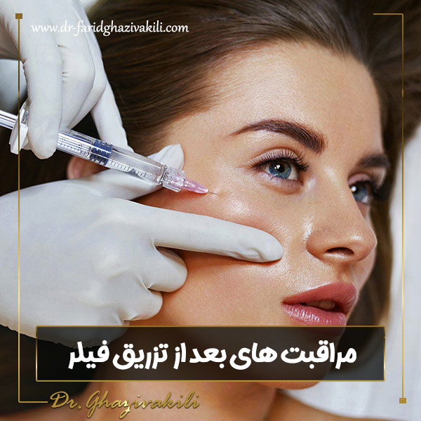 مراقبت های بعد از تزریق فیلر