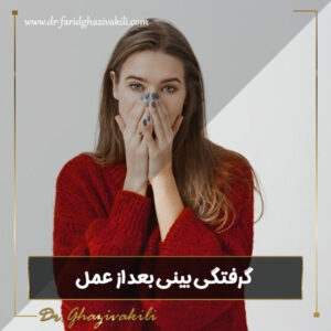 گرفتگی بینی بعد از عمل - دکتر فرید قاضی وکیلی -dr-faridghazivakili.com