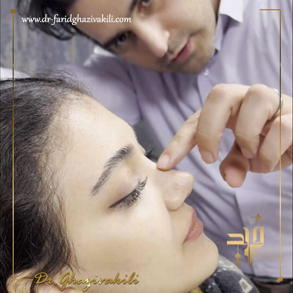 عکس نمونه کار عمل زیبایی بینی فانتزی - دکتر قاضی وکیلی dr-faridghazivakili.com