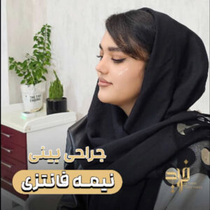 عکس عمل بینی نیمه فانتزی - دکتر قاضی وکیلی - dr-faridghazivakili.com