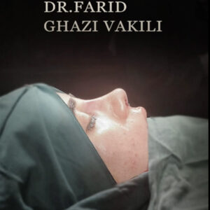 عمل بینی نچرال - دکتر فرید قاضی وکیلی -dr-faridghazivakili.com