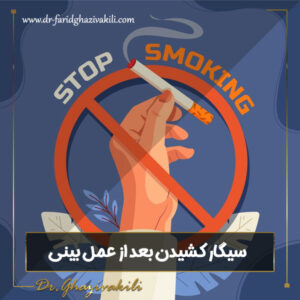 سیگار کشیدن بعد از عمل بینی - دکتر فرید قاضی وکیلی- dr-faridghazivakili.com