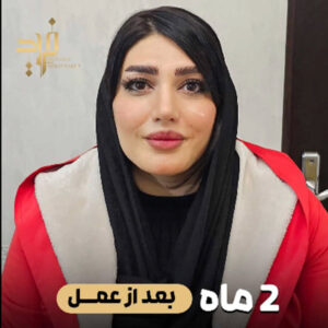 عکس نمونه کار جراحی بینی گوشتی - دکتر قاضی وکیلی - dr-faridghazivakili.com