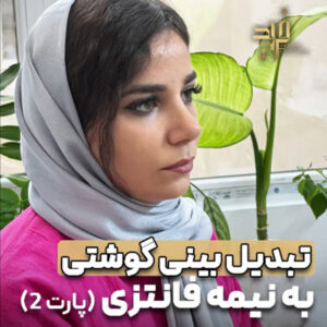 عکس نمونه کار جراحی بینی گوشتی با مدل نیمه فانتزی - دکتر فرید قاضی وکیلی -dr-faridghazivakili.com