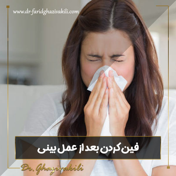 فین کردن بعد از عمل بینی - دکتر فرید قاضی وکیلی 