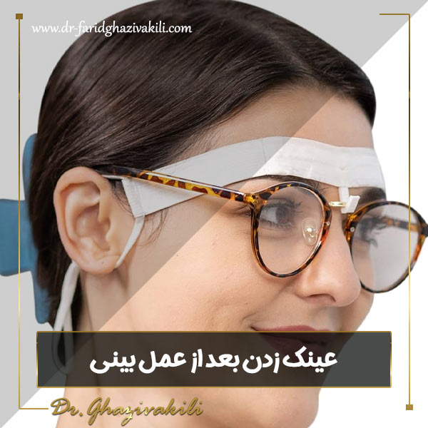 عینک زدن بعد از عمل بینی - دکتر فرید قاضی وکیلی -dr-faridghazivakili.com