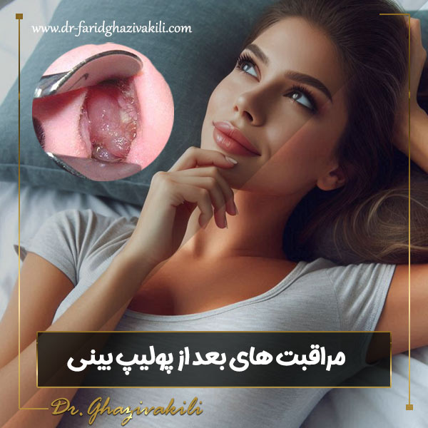 مراقبت های بعد از عمل پولیپ بینی - دکتر فرید قاضی وکیلی - dr-faridghazivakili.com