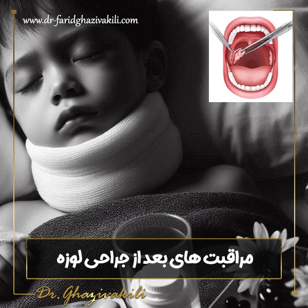 مراقبت های بعد از جراحی لوزه - دکتر فرید قاضی وکیلی - dr-faridghazivakili.com