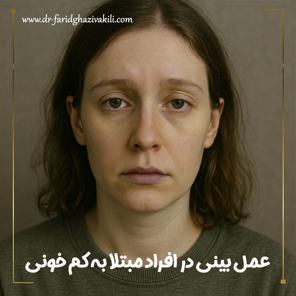 عمل بینی در افراد مبتلا به کم خونی + دکتر فرید قاضی وکیلی