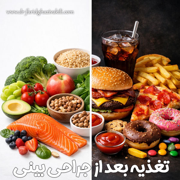 تغذیه بعد از جراحی بینی  + دکتر فرید قاضی وکیلی