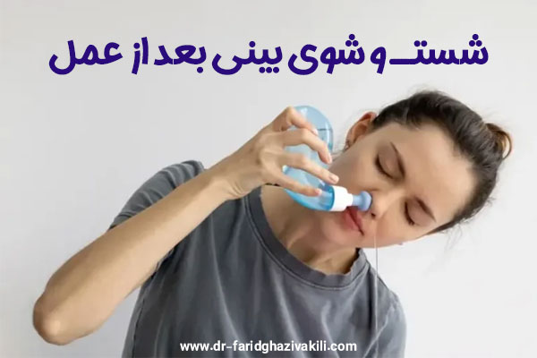 شستشوی بینی بعد از عمل + دکتر فرید قاضی وکیلی