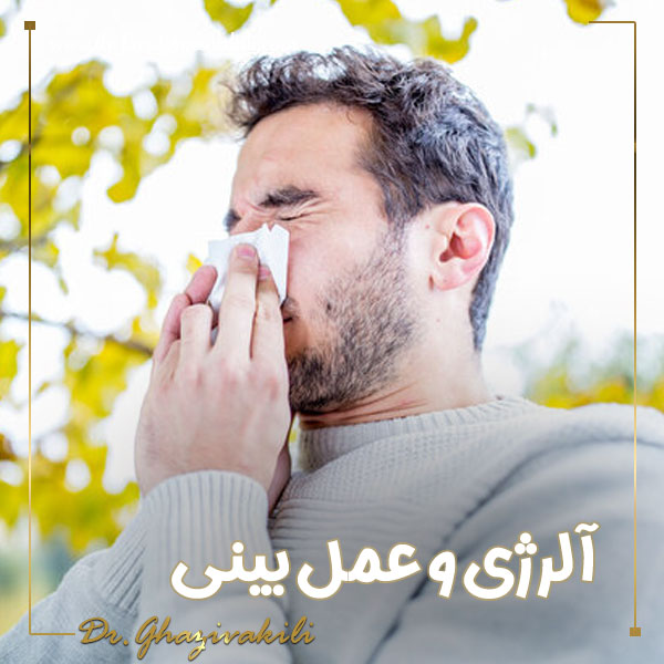 آلرژی و عمل بینی + دکتر فرید قاضی وکیلی